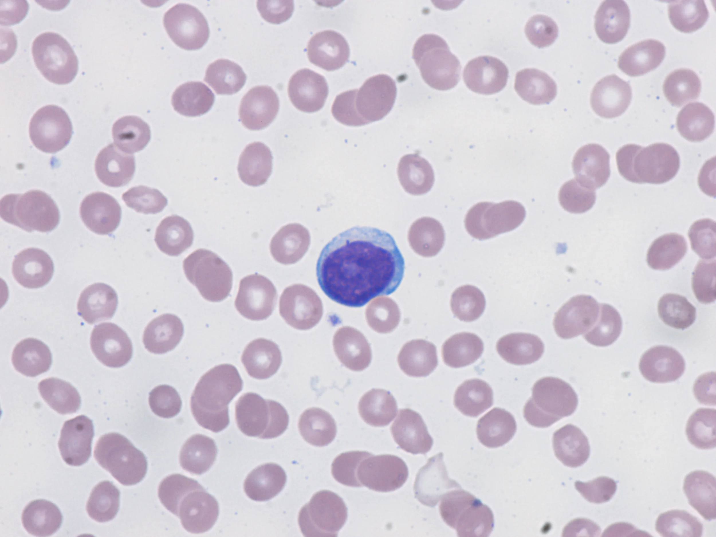 【CRIME】NUCLER BLOOD　Sonosheet Nucleated red blood cell - Wikipedia